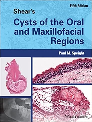 دانلود كتاب Shear’s Cysts of the Oral and Maxillofacial Regions 5th Edition
