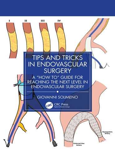 دانلود کتاب Tips and Tricks in Endovascular Surgery