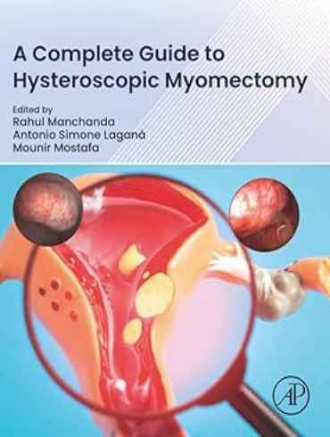 دانلود کتاب A Complete Guide to Hysteroscopic Myomectomy 1st Edition