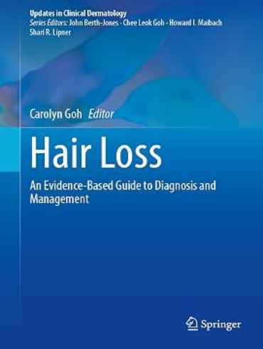 دانلود کتاب Hair Loss: An Evidence-Based Guide to Diagnosis and Management 1st Edition